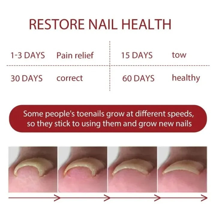 Relief Nail Oil – Extra Strength Care for Discolored & Damaged Nails - BUY 1 GET 1 FREE