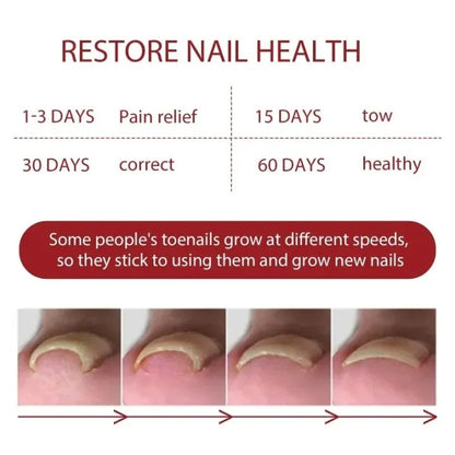 Relief Nail Oil – Extra Strength Care for Discolored & Damaged Nails - BUY 1 GET 1 FREE
